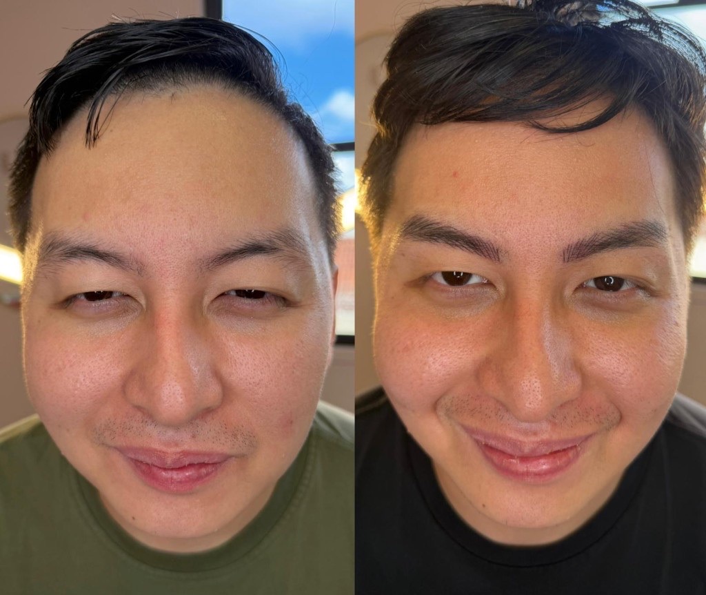Brow correction Honolulu PMU result with balanced eyebrow shape